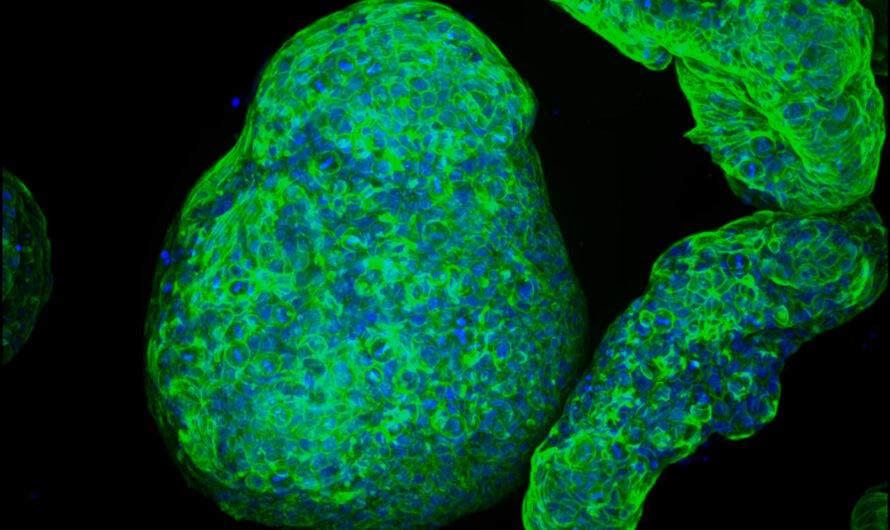 Ingenieros cultivan 'organoides' pancreáticos que imitan la realidad | Noticias del MIT