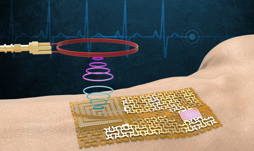 ingenieros construyen una ‘piel’ electrónica inalámbrica y sin chips |  Noticias del MIT