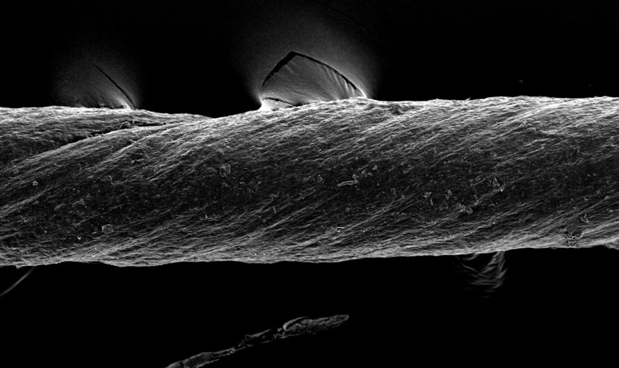 Ingenieros diseñan suturas capaces de administrar fármacos o detectar inflamación |  Noticias del MIT